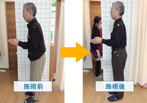 骨盤矯正 姿勢矯正 福島市の接骨院 ふくしま接骨院